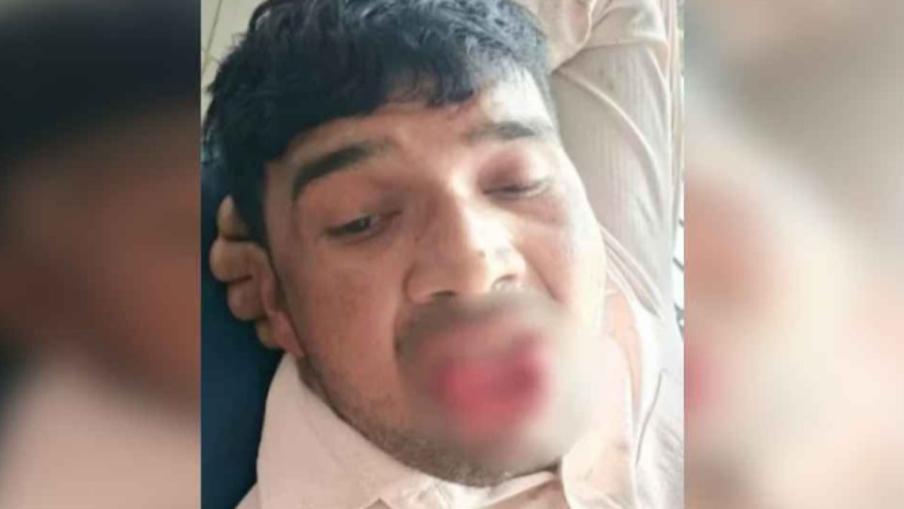 অন্তরঙ্গ মুহুর্তে যে কাণ্ড ঘটালেন প্রেমিকা